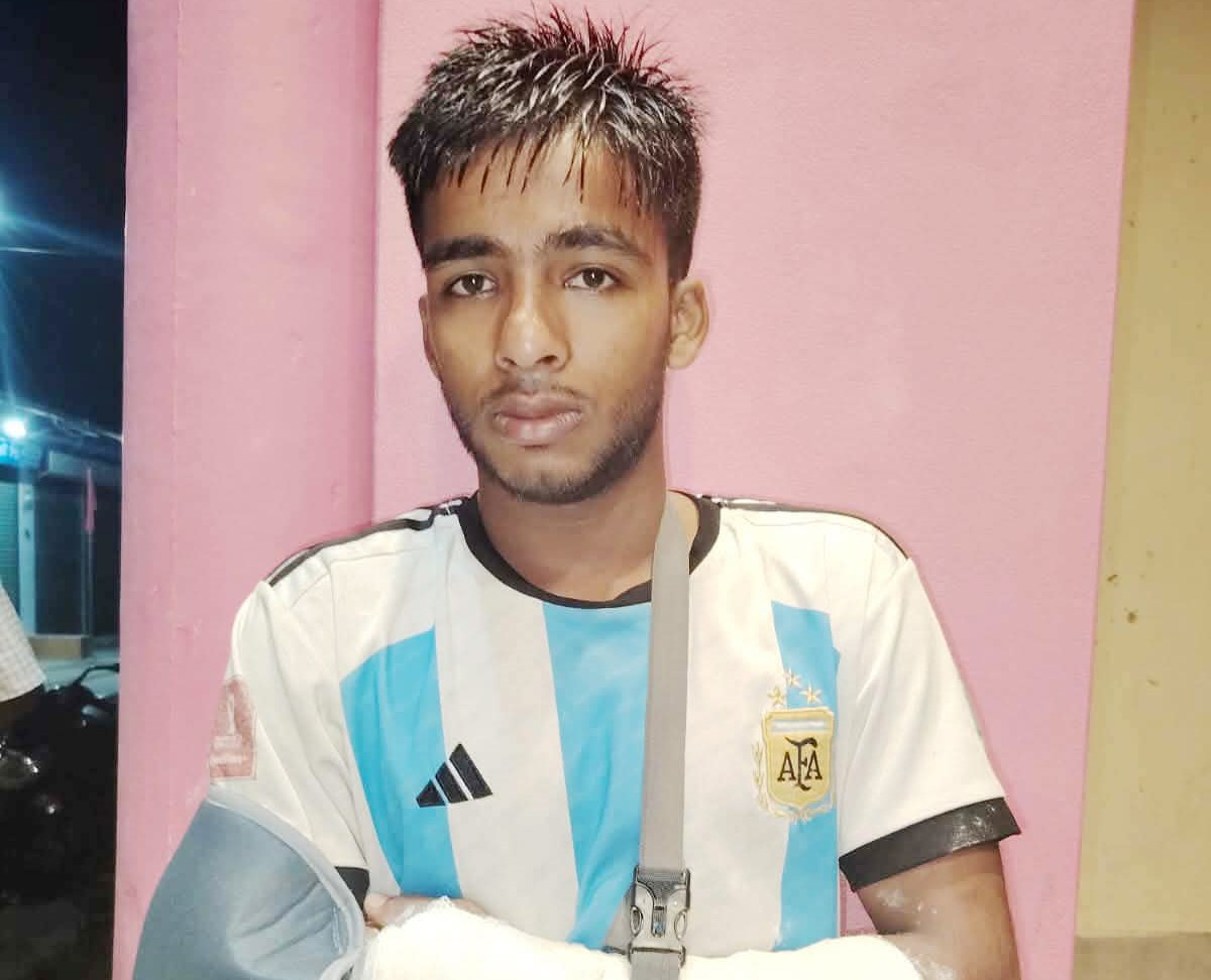 লালমোহনে কলেজ ছাত্রের দুই হাত ভেঙে দিলো কিশোর গ্যাং